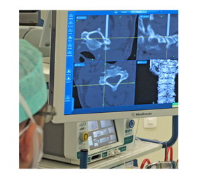 Neurocirugía - Hospital MAZ